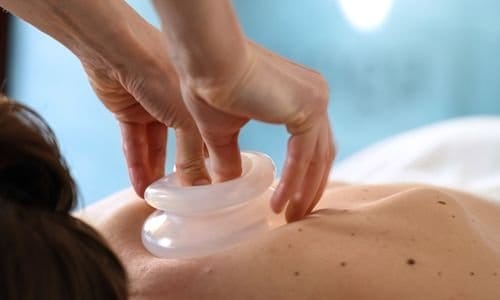 Cupping massage Almere bij Gold and Glow