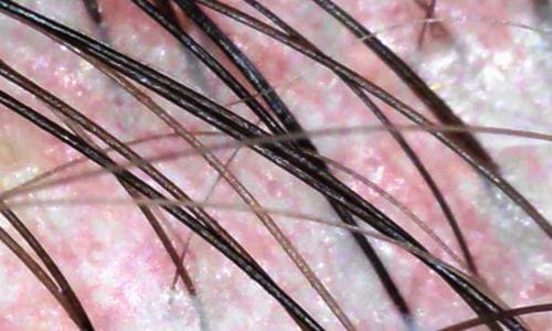 Voor de Japanese Head Spa behandeling bij Gold and Glow, klant Toka - hoofdhuid gespannen en droog