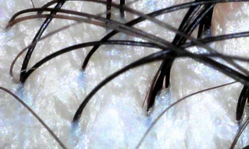 Na de Japanese Head Spa behandeling bij Gold and Glow, klant Toka - hoofdhuid zichtbaar rustiger en gehydrateerd