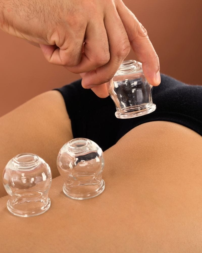 Anti-cellulite cupping Almere bij Gold and Glow